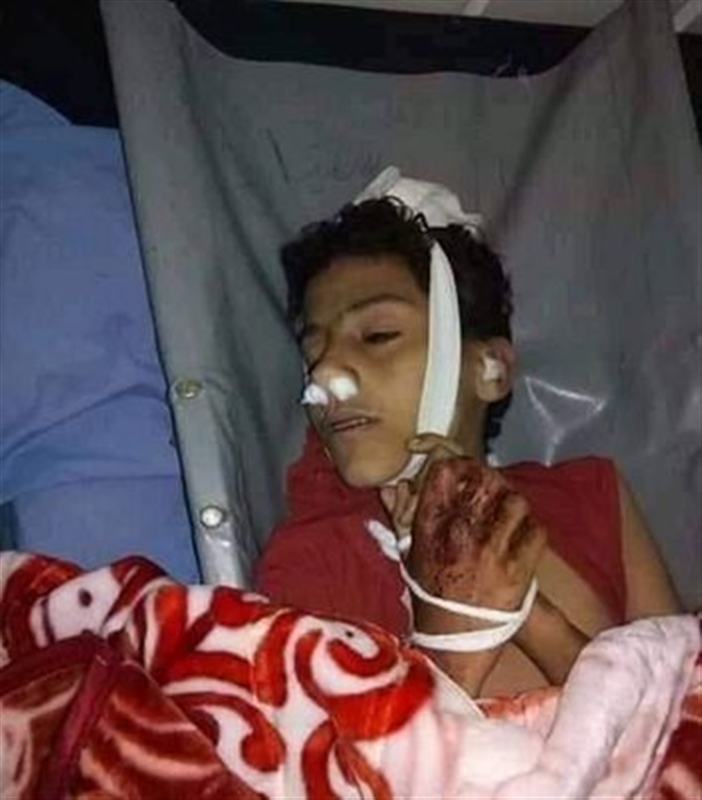 رصاص مليشيا الحوثي يقتل طفل في"الحيمة" شمال تعز 1 رصاص مليشيا الحوثي يقتل طفل في"الحيمة" شمال تعز