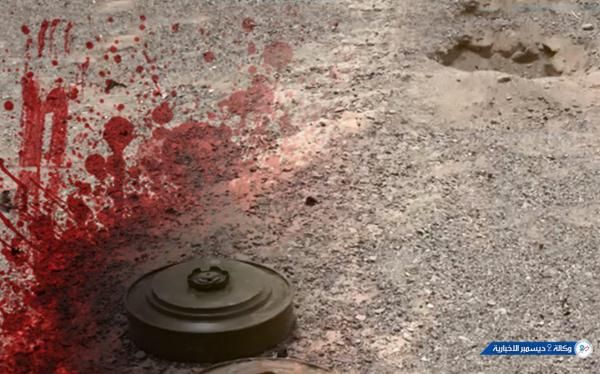 مقتل مواطن وإصابة طفل بلغم حوثي شمال الحزم بالجوف 1 مقتل مواطن وإصابة طفل بلغم حوثي شمال الحزم بالجوف