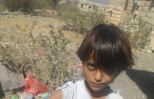 الضالع .. إصابة طفل وأمه جراء قصف حوثي على منازل المواطنين في قعطبة 1 الضالع .. إصابة طفل وأمه جراء قصف حوثي على منازل المواطنين في قعطبة