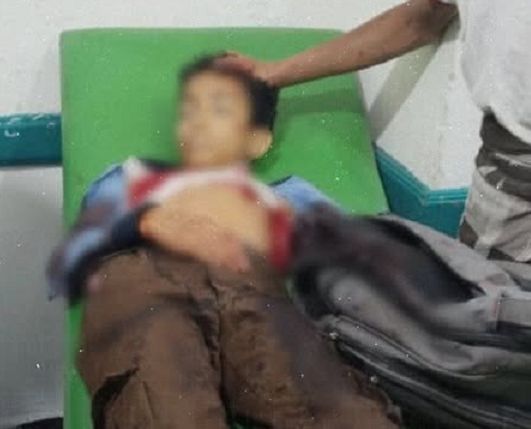 استشهاد طفل بنيران قناص حوثي في حي كلابة بتعز
