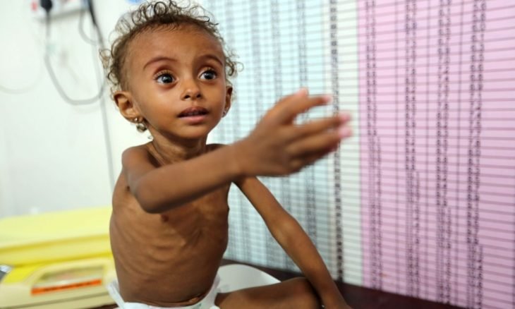 اليونسيف :ملايين الأطفال في اليمن على وشك الموت جوعا بسبب تناقص المساعدات الإنسانية بفعل كورونا 1 اليونسيف :ملايين الأطفال في اليمن على وشك الموت جوعا بسبب تناقص المساعدات الإنسانية بفعل كورونا
