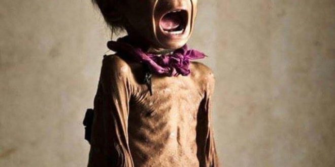 منظمات اممية تحذر مجاعة وشيكة في اليمن