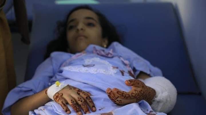 قصف حوثي يصيب طفلة في تعز ويسلبها فرحة العيد