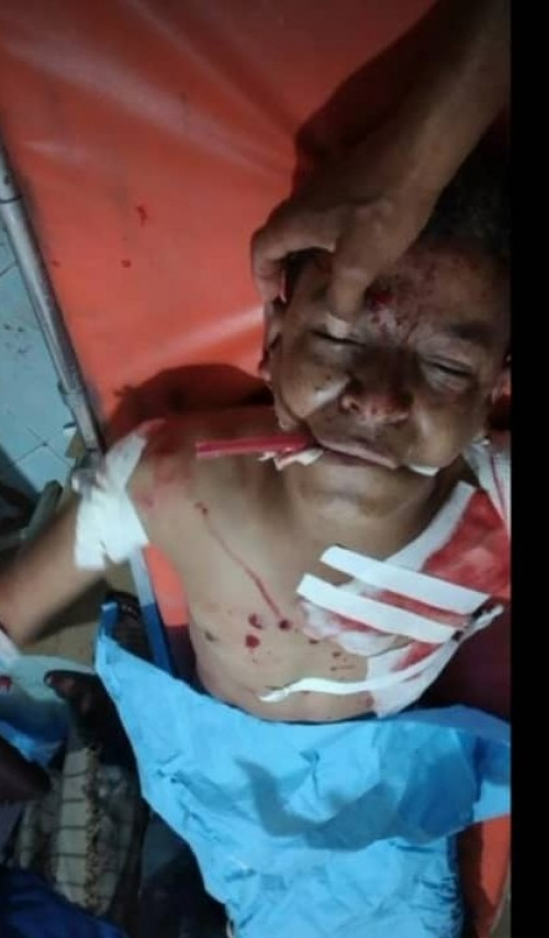انفجار يهز مبنى مدرسة الحمزة بالضالع ويخلف عدد من الجرحى 1 انفجار يهز مبنى مدرسة الحمزة بالضالع ويخلف عدد من الجرحى
