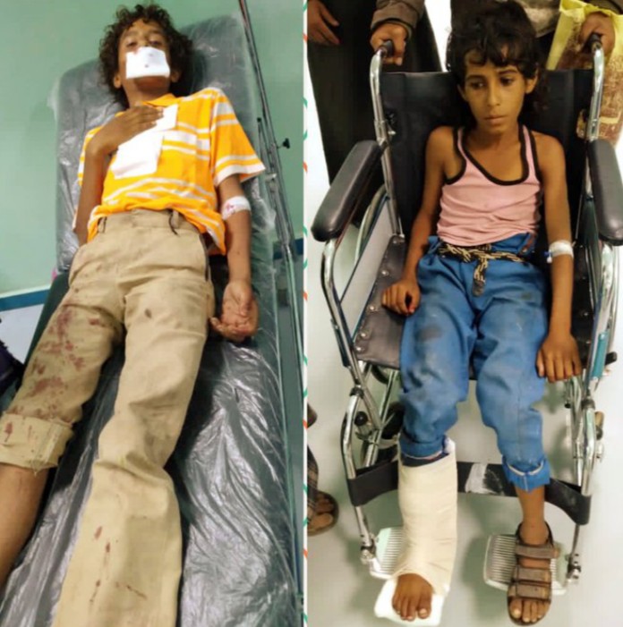 الضالع.. 468 خرقاً للمليشيات الحوثية بينها عشرات القتلى و الجرحى
