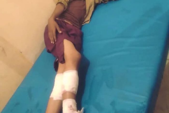 انفجار مقذوف حوثي يصيب طفلا في تعز 1 انفجار مقذوف حوثي يصيب طفلا في تعز
