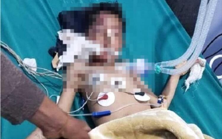 حادث مروري يخلّف إصابات خطيرة لأسرة أثناء انتقالها من إب إلى الضالع 1 حادث مروري يخلّف إصابات خطيرة لأسرة أثناء انتقالها من إب إلى الضالع