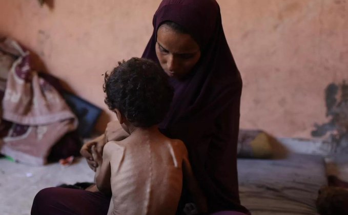 اليونيسف تحذر: عشرات آلاف الأطفال في غزة يواجهون خطر سوء التغذية الحاد