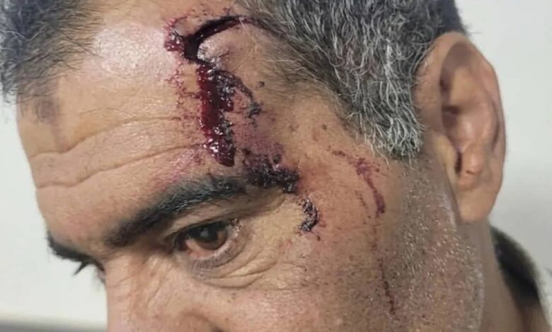 ذمار.. عناصر حوثية تسحل عاقل حارة بسبب الجبايات 1 ذمار.. عناصر حوثية تسحل عاقل حارة بسبب الجبايات