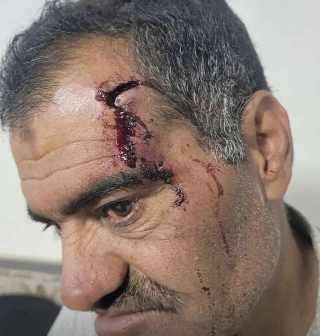 ذمار.. عناصر حوثية تسحل عاقل حارة بسبب الجبايات