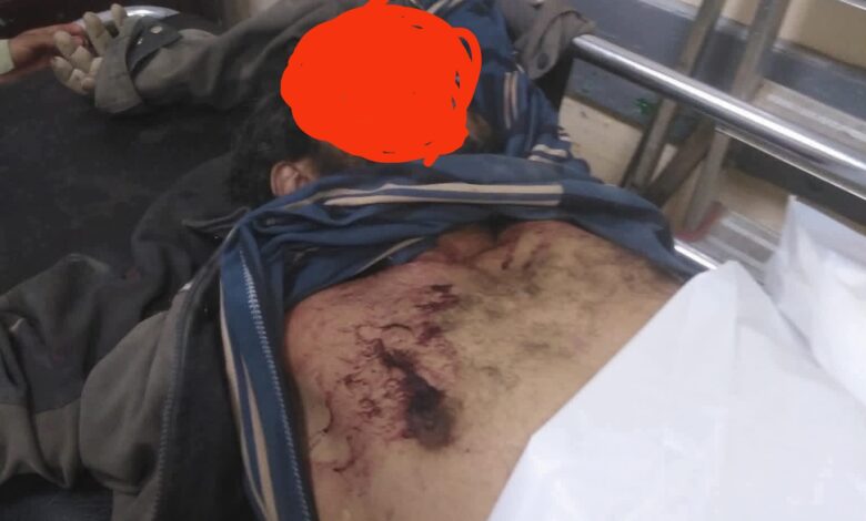 مقتل عامل في صعدة على يد قيادي حوثي بسبب خلاف مالي 1 مقتل عامل في صعدة على يد قيادي حوثي بسبب خلاف مالي