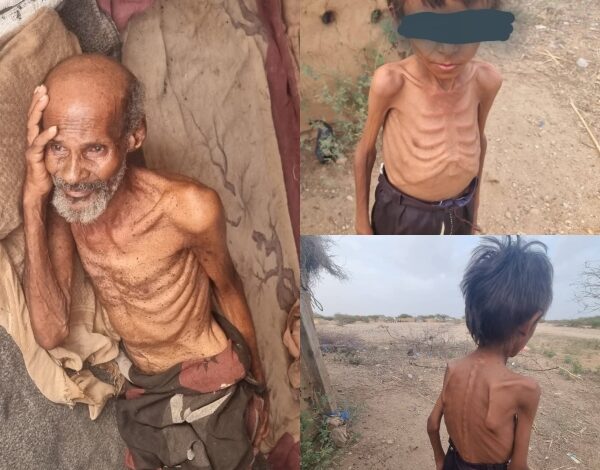 وفاة مسن وطفل في مخيمات عبس نتيجة الجوع وسوء التغذية
