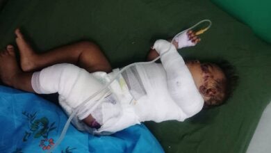 حريق يلتهم منزل أسرة ويصيب طفلين في الحديدة 7 حريق يلتهم منزل أسرة ويصيب طفلين في الحديدة