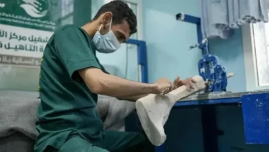الأطراف الصناعية بمأرب يقدّم أكثر من 1500 خدمة طبية وتأهيلية خلال مايو