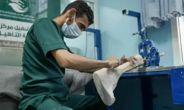 الأطراف الصناعية بمأرب يقدّم أكثر من 1500 خدمة طبية وتأهيلية خلال مايو 1 الأطراف الصناعية بمأرب يقدّم أكثر من 1500 خدمة طبية وتأهيلية خلال مايو