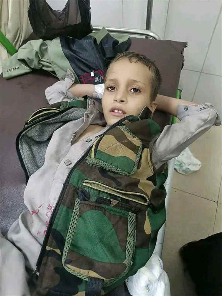 وفاة طفل بداء الكلب في حجة بعد 40 يوماً من تعرضه لعضة قط