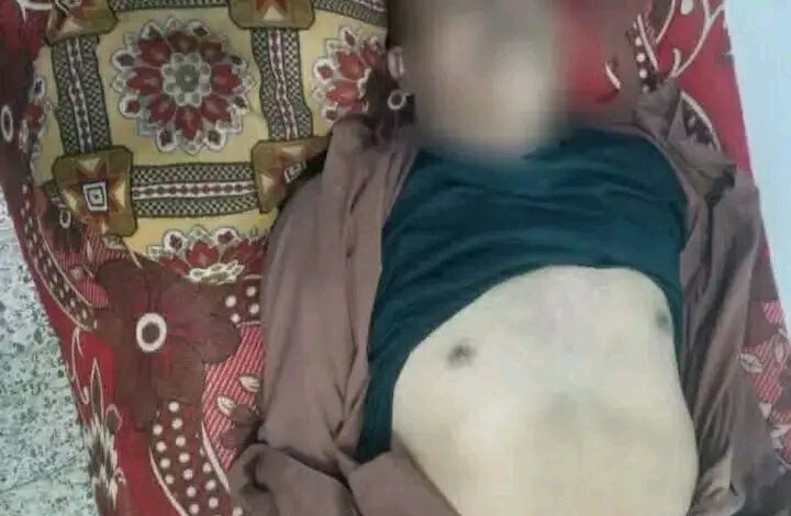 ذمار.. وفاة مواطن بصاعقة رعدية ضربت منزله في وصاب السافل