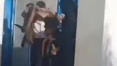 حادثة مروعة في صنعاء: لبوة تهاجم طفلًا وتفقده يده