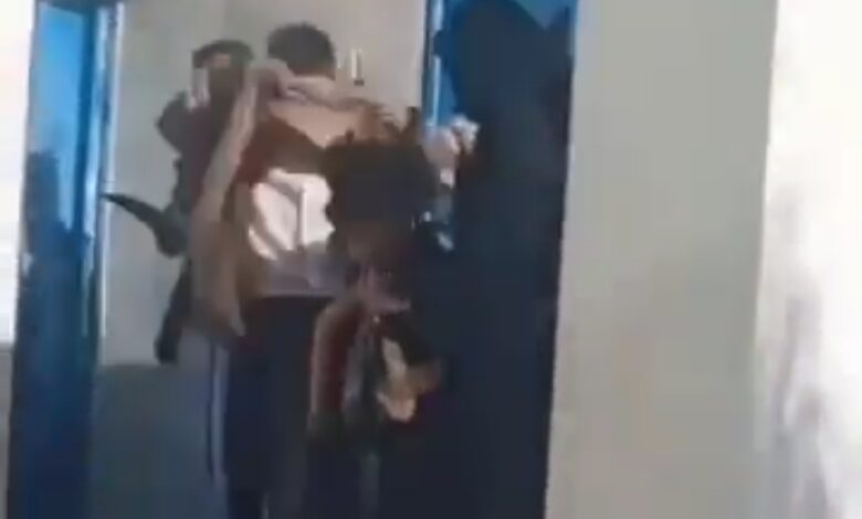حادثة مروعة في صنعاء: لبوة تهاجم طفلًا وتفقده يده