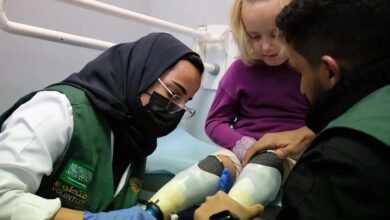 بدعم سلمان للإغاثة.. مراكز الأطراف الصناعية تقدم أكثر من 47 ألف خدمة تأهيلية في اليمن