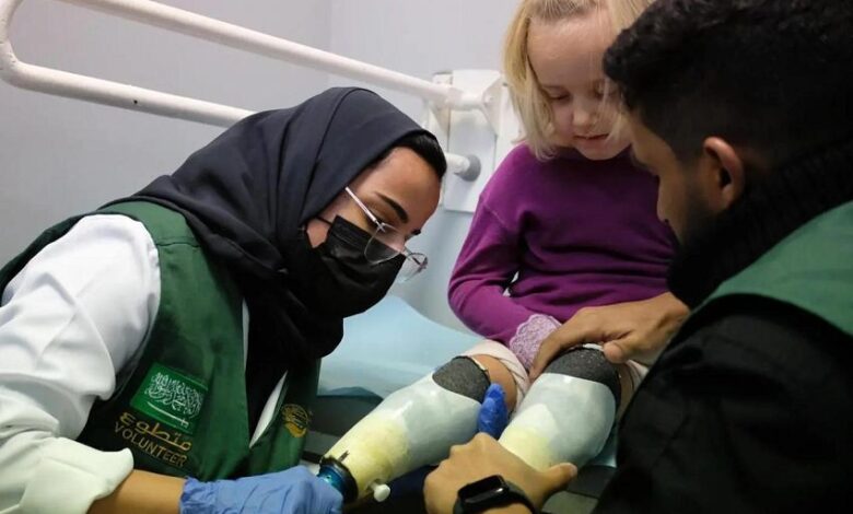 بدعم سلمان للإغاثة.. مراكز الأطراف الصناعية تقدم أكثر من 47 ألف خدمة تأهيلية في اليمن