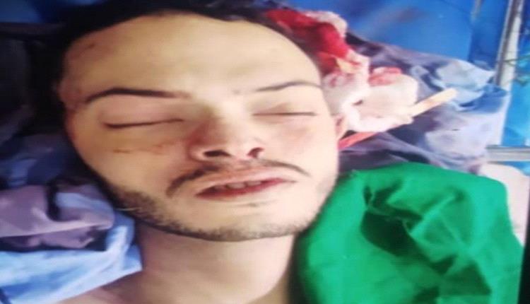 قيادي في مليشيا الحوثي ينهي حياة نجله بالرصاص داخل منزله في صنعاء
