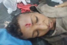 إصابة طفل بانفجار مقذوف من مخلفات مليشيا الحوثي في حيس