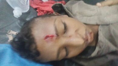 إصابة طفل بانفجار مقذوف من مخلفات مليشيا الحوثي في حيس