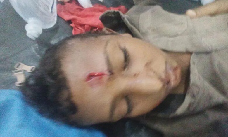 إصابة طفل بانفجار مقذوف من مخلفات مليشيا الحوثي في حيس