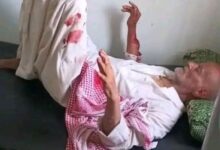 حادثة اعتداء مروعة تهز مديرية مقبنة غربي تعز وسط دعوات لتحرك عاجل