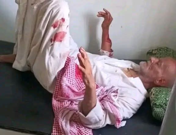 حادثة اعتداء مروعة تهز مديرية مقبنة غربي تعز وسط دعوات لتحرك عاجل 1 حادثة اعتداء مروعة تهز مديرية مقبنة غربي تعز وسط دعوات لتحرك عاجل
