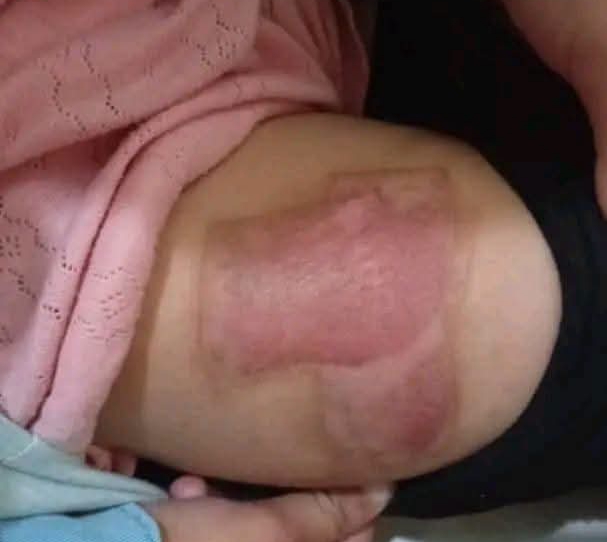 تعز.. مطالبات بتحقيق عاجل في واقعة تعذيب أطفال على يد زوجة أبيهم بالمواسط