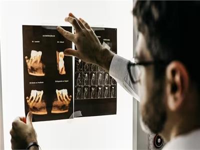 علامات في الفم قد تنذر بخطر سرطان القولون والمستقيم 1 علامات في الفم قد تنذر بخطر سرطان القولون والمستقيم