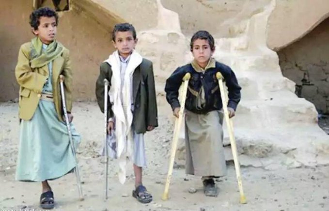 أكثر من 20 ألف مدني ضحايا ألغام الحوثي منذ بدء الحرب 1 أكثر من 20 ألف مدني ضحايا ألغام الحوثي منذ بدء الحرب