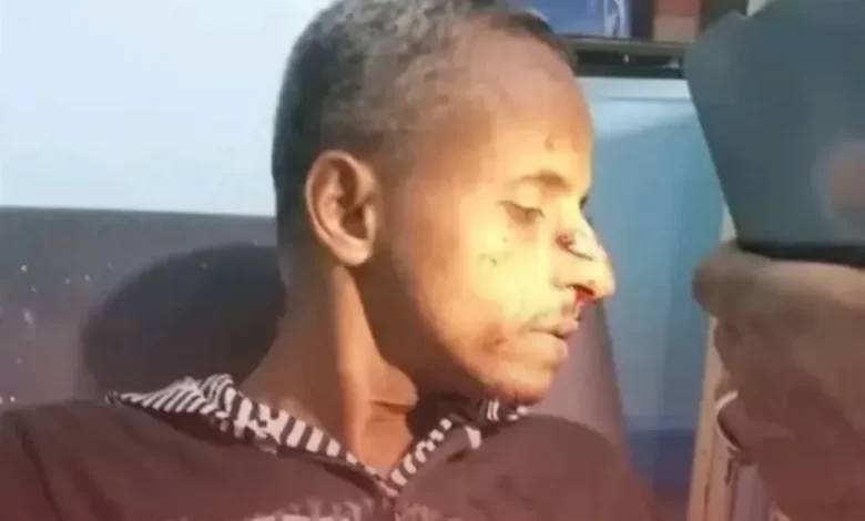 مقتل وإصابة 3 مواطنين برصاص مسلح في سوق شعبي شمال غرب تعز
