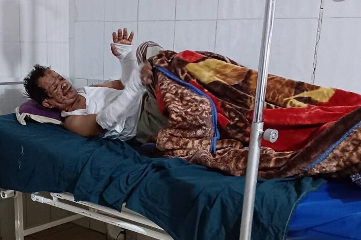 مليشيا الحوثي تتنصل من علاج بائع الزلابية وتلاحق ناشري الحادثة