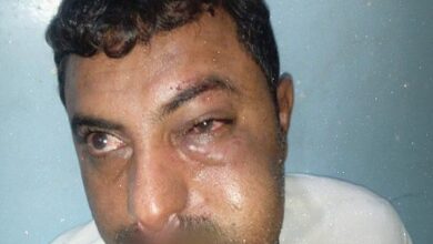 قيادي حوثي يعتدي على محامٍ في الحديدة وسط تصاعد الانتهاكات 4 قيادي حوثي يعتدي على محامٍ في الحديدة وسط تصاعد الانتهاكات