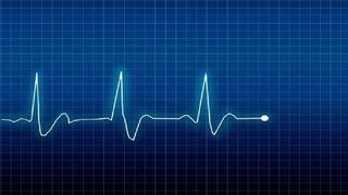 متى يكون إرتفاع معدل ضربات القلب خطيراً؟ 1 متى يكون إرتفاع معدل ضربات القلب خطيراً؟