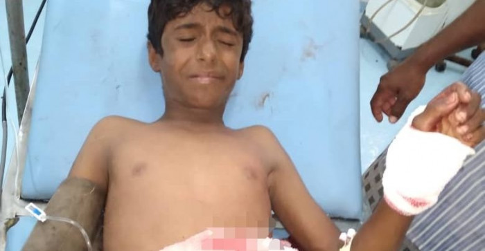 إصابة مراهق إثر إنفجار مقذوف من مخلفات الحوثي بالتحيتا 1 إصابة مراهق إثر إنفجار مقذوف من مخلفات الحوثي بالتحيتا