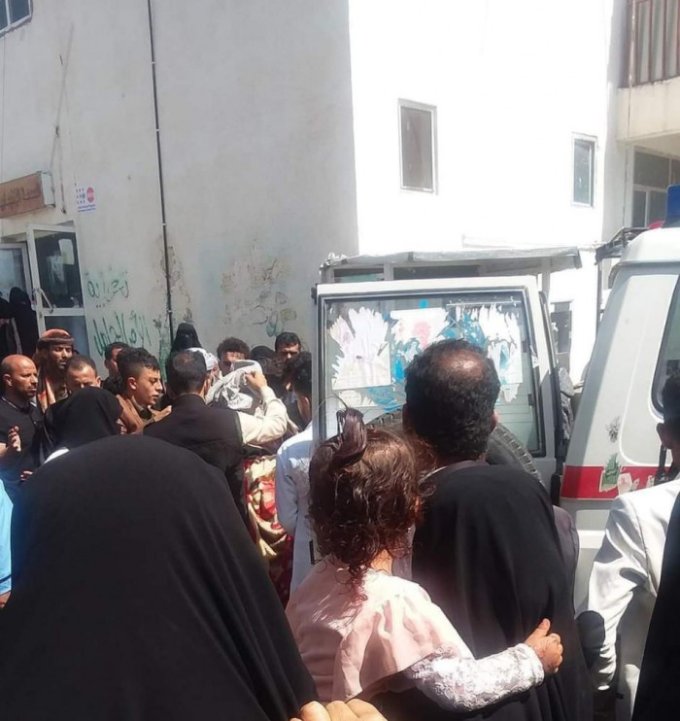 إب .. زوج يعتدي على زوجته ويهشم رأسها بمطرقة