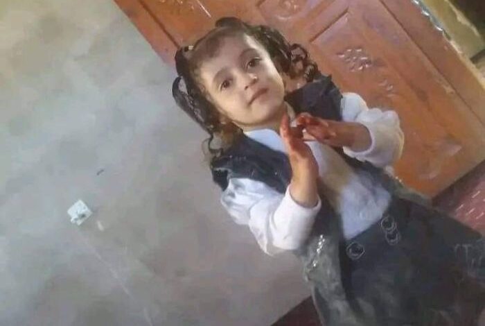 وفاة طفلين جراء التعذيب الوحشي في صنعاء وريمة