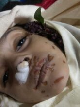 وفاة طفلين جراء التعذيب الوحشي في صنعاء وريمة