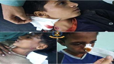 الضالع.. انفجار مقذوف حوثي في 3 أطفال بمنطقة حجر