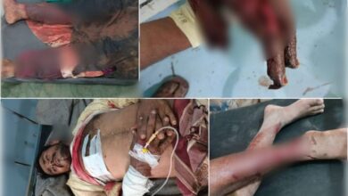 انفجار لغم حوثي يصيب ثلاثة مدنيين جنوب الحديدة