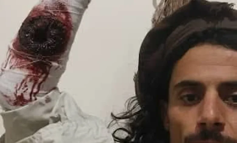 مليشيا الحوثي تواصل انتهاكاتها: حصار منزل شاب جريح في مدينة رداع 1 مليشيا الحوثي تواصل انتهاكاتها: حصار منزل شاب جريح في مدينة رداع