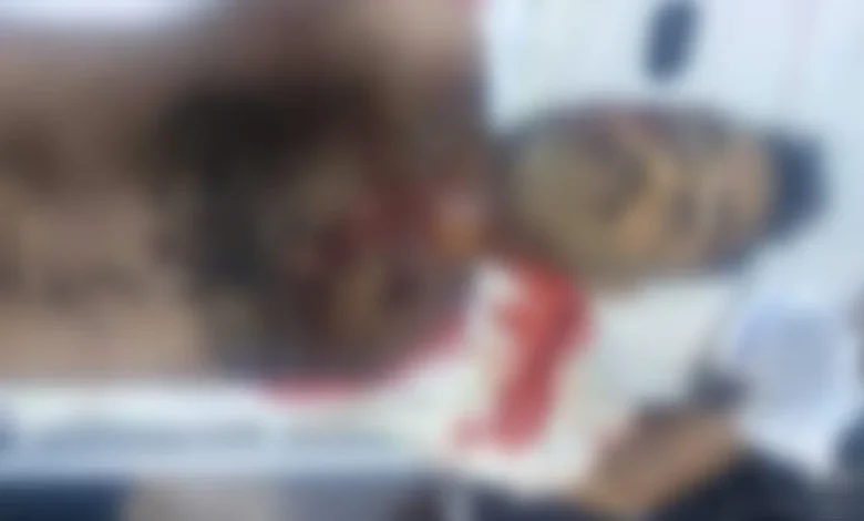 مليشيا الحوثي تقتل 8 مدنيين باعتداء متعمد وقت الإفطار في حجة 1 مليشيا الحوثي تقتل 8 مدنيين باعتداء متعمد وقت الإفطار في حجة