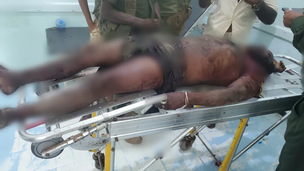 مقتل مواطن بانفجار مقذوف من مخلفات مليشيا الحوثي في الخوخة 1 مقتل مواطن بانفجار مقذوف من مخلفات مليشيا الحوثي في الخوخة