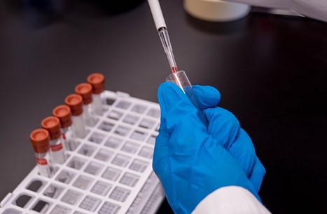 علماء بريطانيون يبشرون بلقاح لكورونا خلال 3 أشهر 1 علماء بريطانيون يبشرون بلقاح لكورونا خلال 3 أشهر
