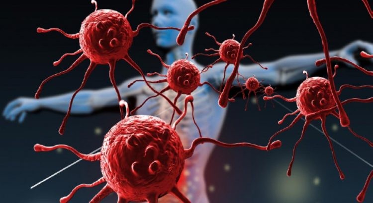 5 أعراض غير متوقعة لنمو السرطان .. تعرف عليها