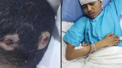 عناصر حوثية تطلق النار على طفل في الحديدة